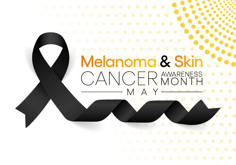 Melanoma: maggio il mese della consapevolezza del cancro della pelle